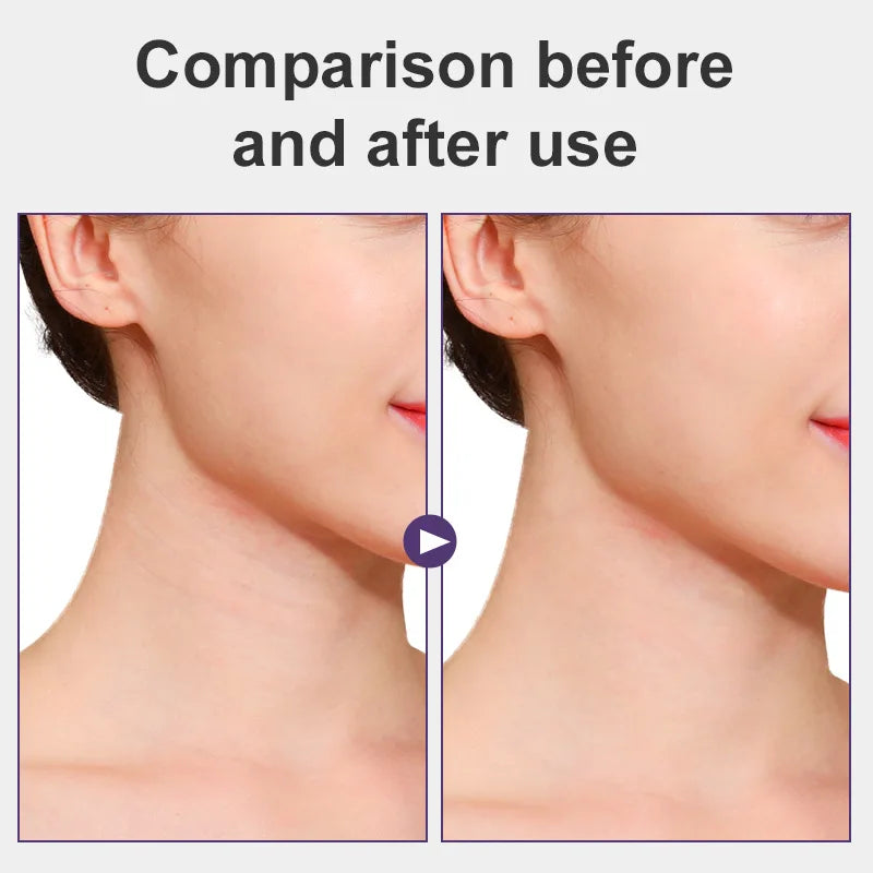 Youthful Glow™ Neck Lifting Tape – Instant Lift for a Smooth, Firm & Younger-Looking Neck